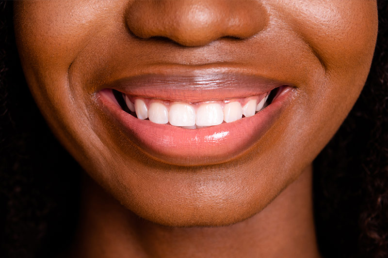 Addressing Gummy Smile and Uneven Gum Line Westfield