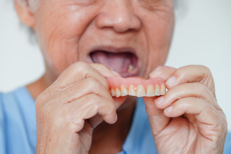 Full Dentures Westfield