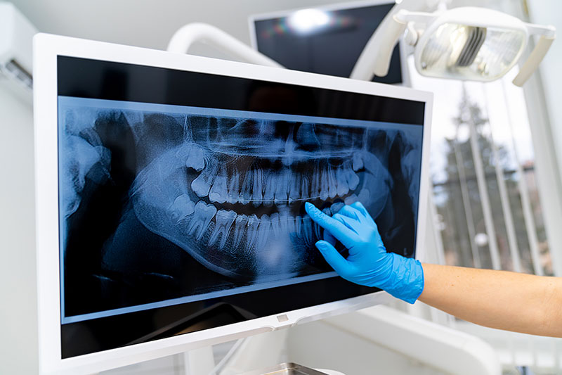 Digital X-rays in Westfield